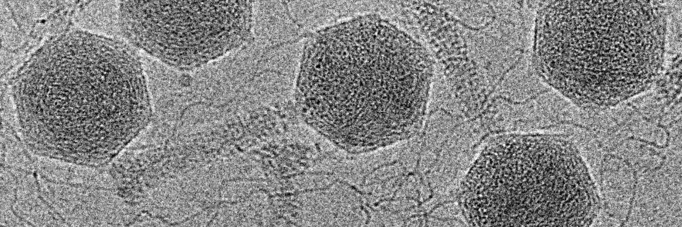 TEM of phage virus